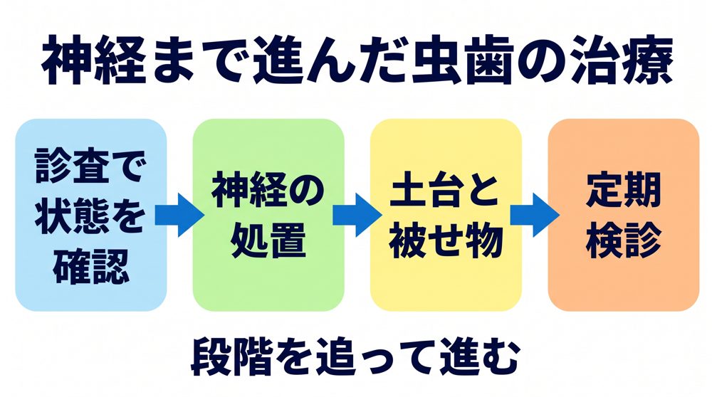 虫歯が神経まで進んだときの治療は、診査・神経の処置・土台と被せ物・定期検診の順に進む